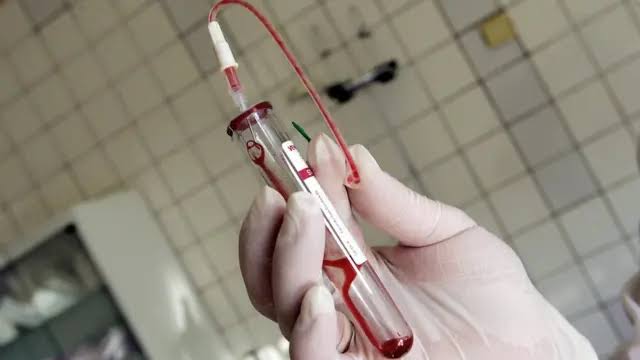 Türkiye’de AIDS’li Çocuk Sayısı Endişe Verici Boyutta Artıyor