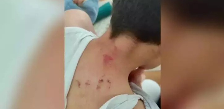 Şanlıurfa’da Öğretmen Şiddeti, Eğitim Camiasında İnfial Yarattı!